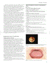 ABC of Clinical Genetics 3rd Edition