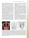 Patient Preparation and Performance of PET CT Scans in Pediatric Patients