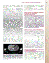 Patient Preparation and Performance of PET CT Scans in Pediatric Patients