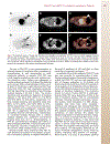 Patient Preparation and Performance of PET CT Scans in Pediatric Patients