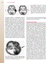 Patient Preparation and Performance of PET CT Scans in Pediatric Patients