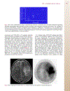 Patient Preparation and Performance of PET CT Scans in Pediatric Patients