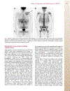 Patient Preparation and Performance of PET CT Scans in Pediatric Patients