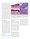 Pathology Genetics Tumours of the Lung