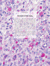 Pathology Genetics Tumours of the Lung