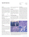 Pathology Genetics Tumours of the Lung