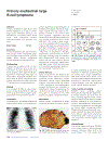 Pathology Genetics Tumours of the Lung