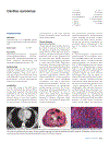 Pathology Genetics Tumours of the Lung