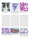 Pathology Genetics Tumours of the Lung