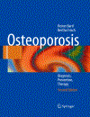 Osteoporosis Diagnosis