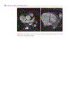 Cardiovascular MRI in Congenital Heart Disease