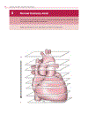 Cardiovascular MRI in Congenital Heart Disease