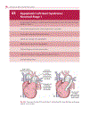 Cardiovascular MRI in Congenital Heart Disease