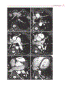 Cardiovascular MRI in Congenital Heart Disease