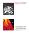 Cardiovascular MRI in Congenital Heart Disease