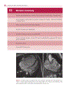 Cardiovascular MRI in Congenital Heart Disease