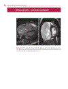 Cardiovascular MRI in Congenital Heart Disease