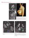 Cardiovascular MRI in Congenital Heart Disease