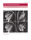 Cardiovascular MRI in Congenital Heart Disease