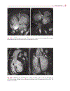 Cardiovascular MRI in Congenital Heart Disease