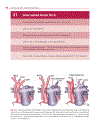 Cardiovascular MRI in Congenital Heart Disease