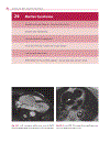 Cardiovascular MRI in Congenital Heart Disease