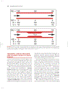 Cardiovascular Physiology Concepts