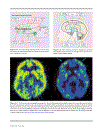 An Atlas of Depression 1st Edition