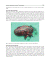 Understanding the Complexities of Kidney Transplantation