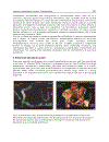 Understanding the Complexities of Kidney Transplantation