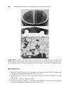 Welding Metallurgy