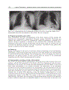 Cardiac Pacemakers Biological Aspects