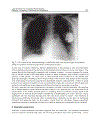 Cardiac Pacemakers Biological Aspects