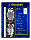 Giải phẫu thần kinh đối chiếu chẩn đoán hình ảnh