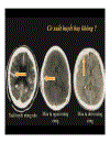 CT Scan trong tai biến mạch máu não