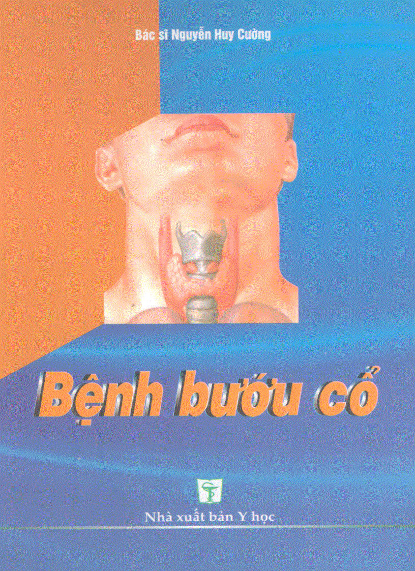 Bệnh bướu cổ