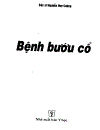 Bệnh bướu cổ