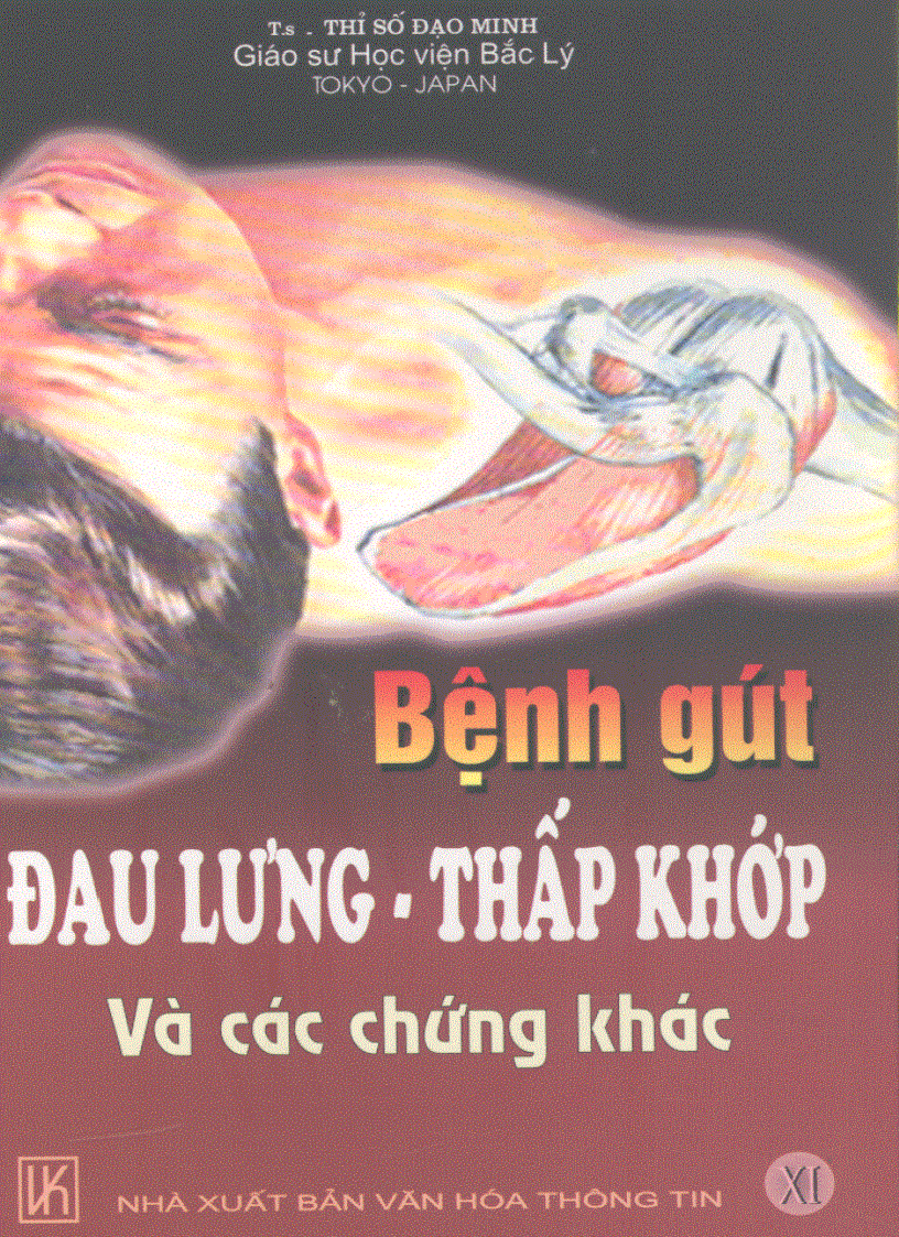 Bệnh gút