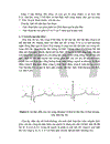 phương pháp nhận dạng hình dáng tín Hiệu điện tim 1