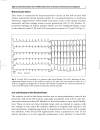 Cardiac Arrhythmias 2005 Proceedings of the 9th International Workshop on Cardiac Arrhythmias