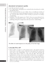 A Z of Chest Radiology