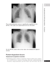 A Z of Chest Radiology