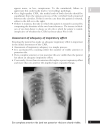 A Z of Chest Radiology