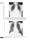 A Z of Chest Radiology