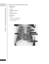 A Z of Chest Radiology