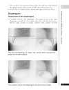 A Z of Chest Radiology