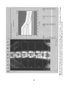 Bone Densitometry for Technologists