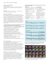 ABC of Interventional Cardiology