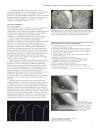 ABC of Interventional Cardiology