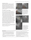 ABC of Interventional Cardiology